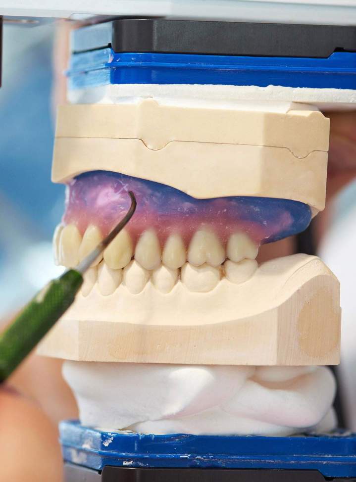 Prothèses sur implants Charny